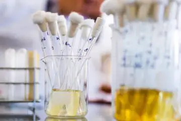 Sediment in Your Urine: Here Is What It Really Means