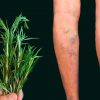 How to Make Alcohol Rosemary That Helps with Gout, Muscle Ache, Varicose Veins, and Cellulite