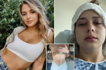 24-Year-Old Diagnosed with Stage 3 Cancer After Overlooking Continous Burping