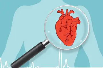 The Truth about Clogged Arteries & Heart Disease