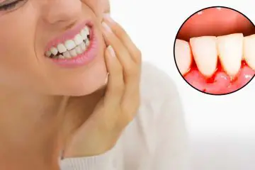 10 Worst Habits: They Cause Bad Breath, Bleeding Gums & Yellow Teeth