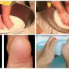 Stop Wasting Money on Pedicures: You Just Need These 2 Ingredients from Your Kitchen & Your Feet Will Look Amazing