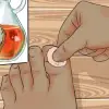 Use This Potent Turmeric & Oil DIY Paste to Get Rid of Ingrown Toenails & Warts