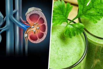 Lemon & Parsley Syrup: A Potent Combo to Dissolve Kidney Stones