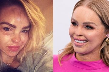 Katie Piper Issues an Urgent Warning About the Hot Water Bottle Flower