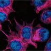 Scientist Treats Her Own Breast Cancer Using Lab-Grown Viruses And She Succeeds