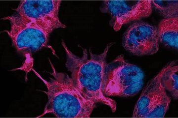 Scientist Treats Her Own Breast Cancer Using Lab-Grown Viruses And She Succeeds