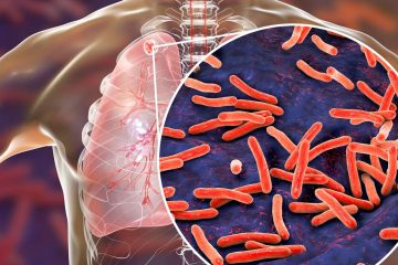 The World Has A New Leading Infectious Killer – And It’s Not COVID-19